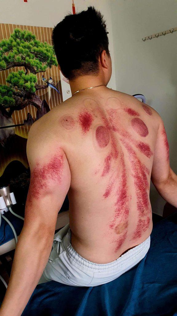 Vật lý trị liệu từ tâm